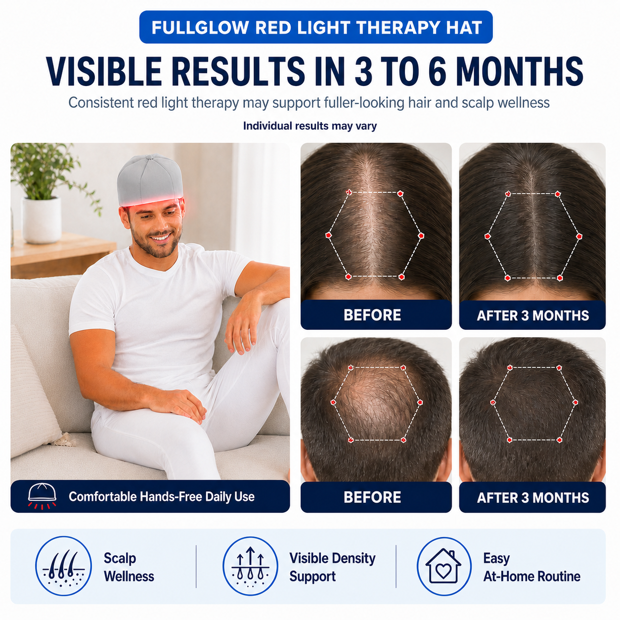 FullGlow Red Light and Infrared Therapy Hat